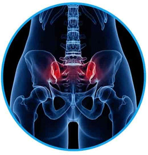 Pelvic pain